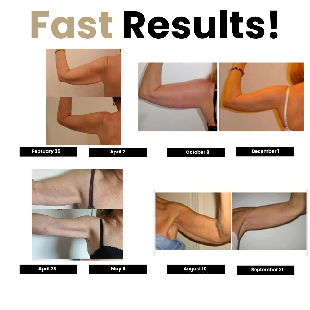 SILIX 3D Compression Sleeves – Say Goodbye to Arm Jiggle